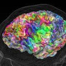colorful image of brain